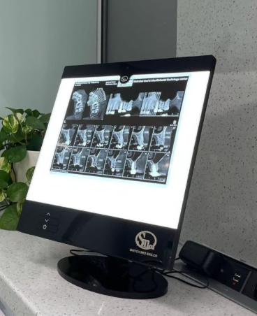 Medical LED X-Ray Viewer (Negatoscope)